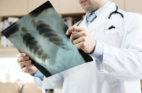 INDUSTRIAL DISEASE - Our unique, specialist service