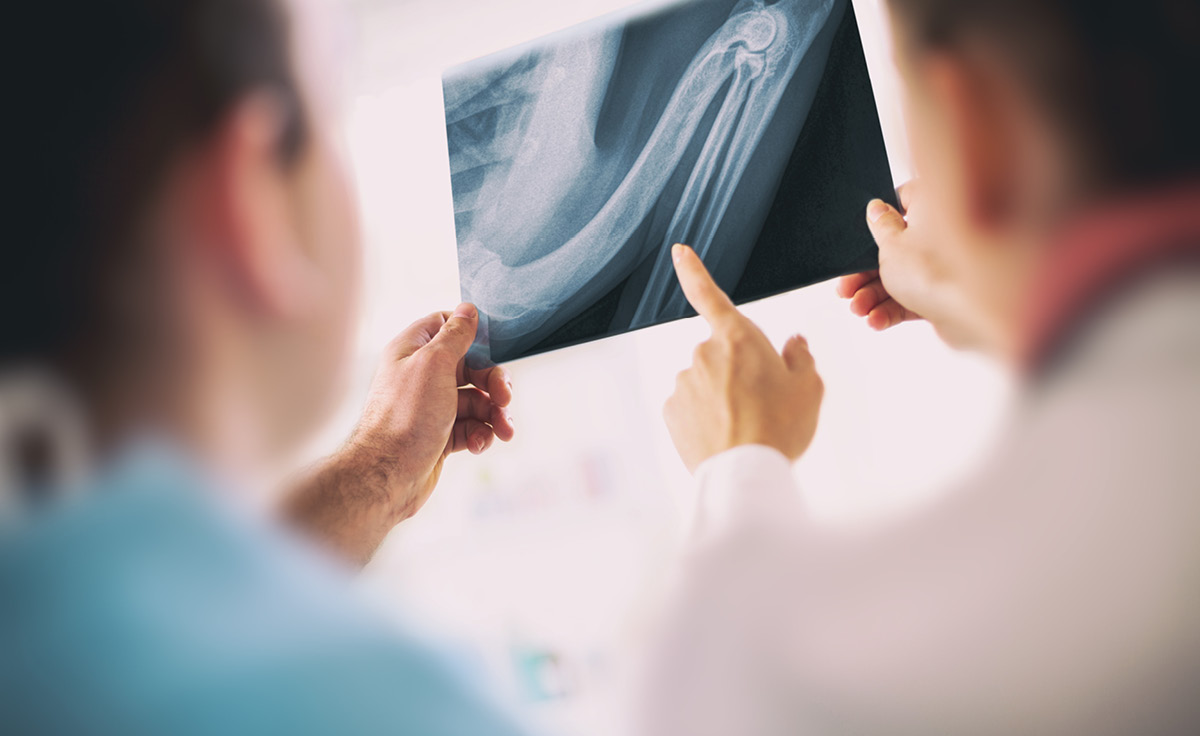 Who are the best experts for Medical Negligence cases?