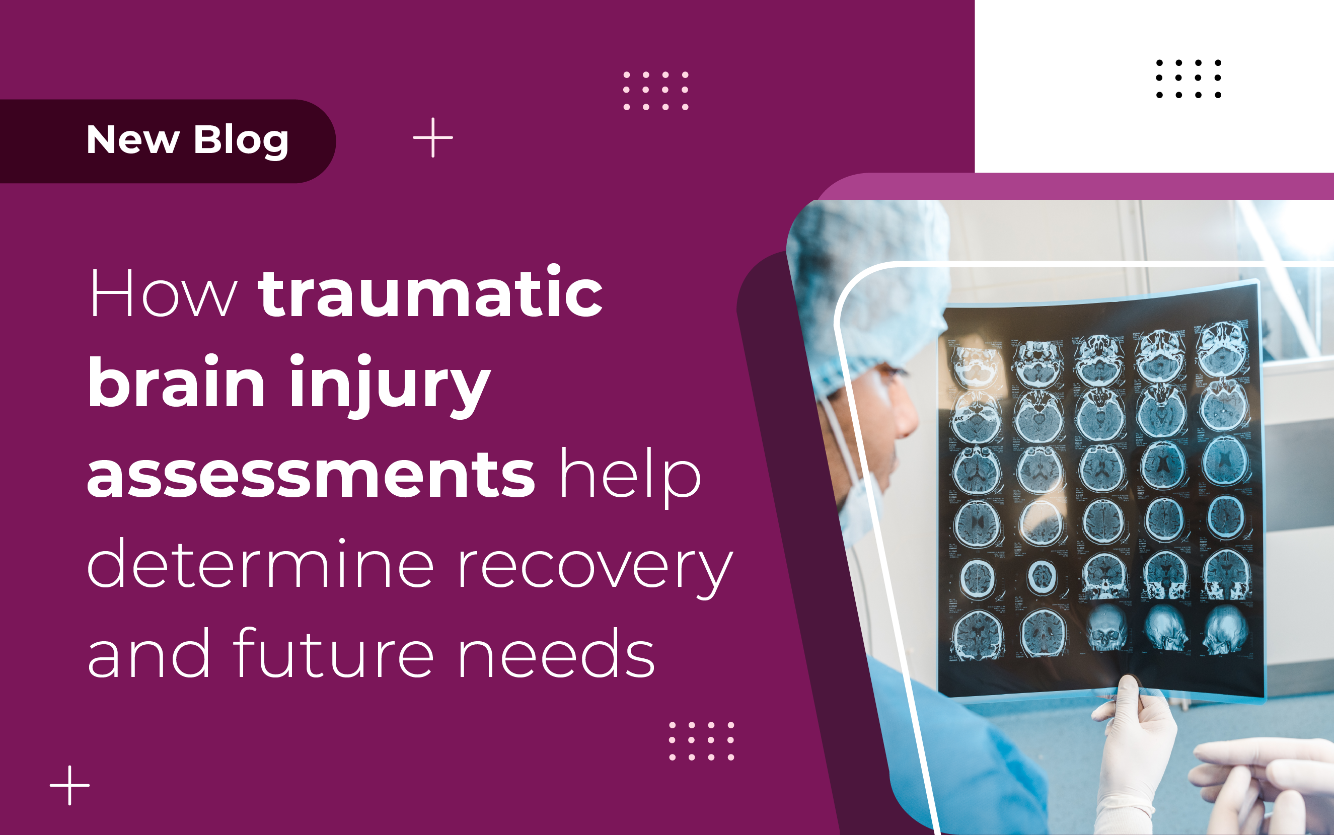 How traumatic brain injury assessments help determine recovery and future needs